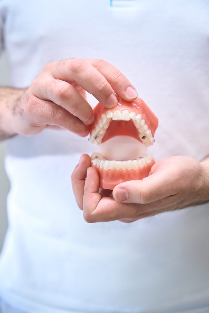 Dentist demonstrates dental aligners on the model of the jaws