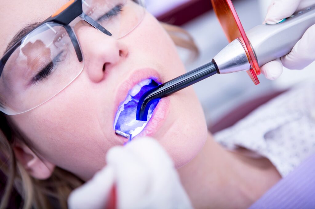 Hardening of dental filling at the dentist
